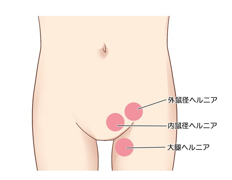 足 の 付け根 押す と 痛い